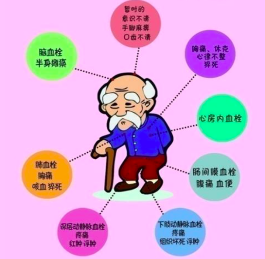 202306280935068954.Png
